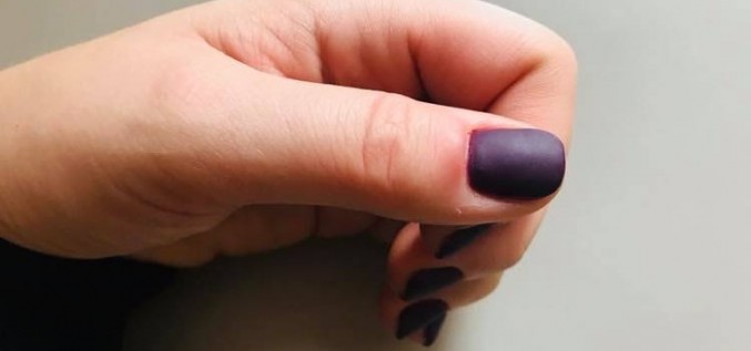 Paronīhija jeb naga valnīša iekaisums